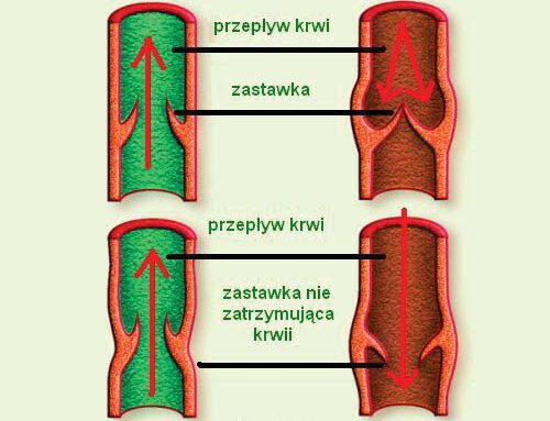 Czym grozi olewanie swojego zdrowia?